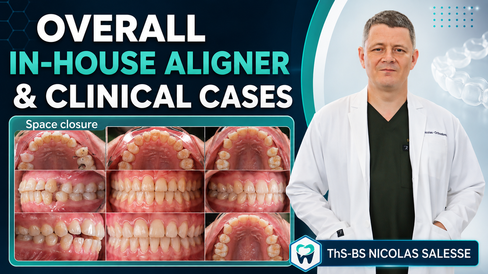 OVERALL IN HOUSE ALIGNER & CLINICAL CASES